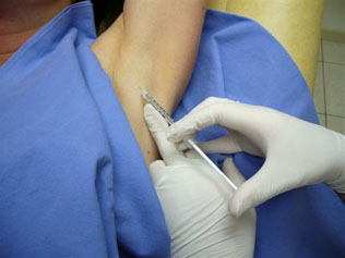 Injections de Botox pour le traitement de la transpiration excessive des aisselles